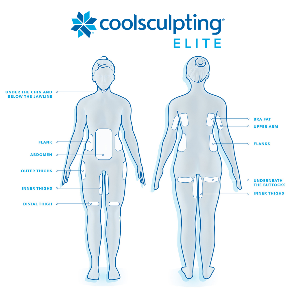 CoolSculpting Elite treatment areas